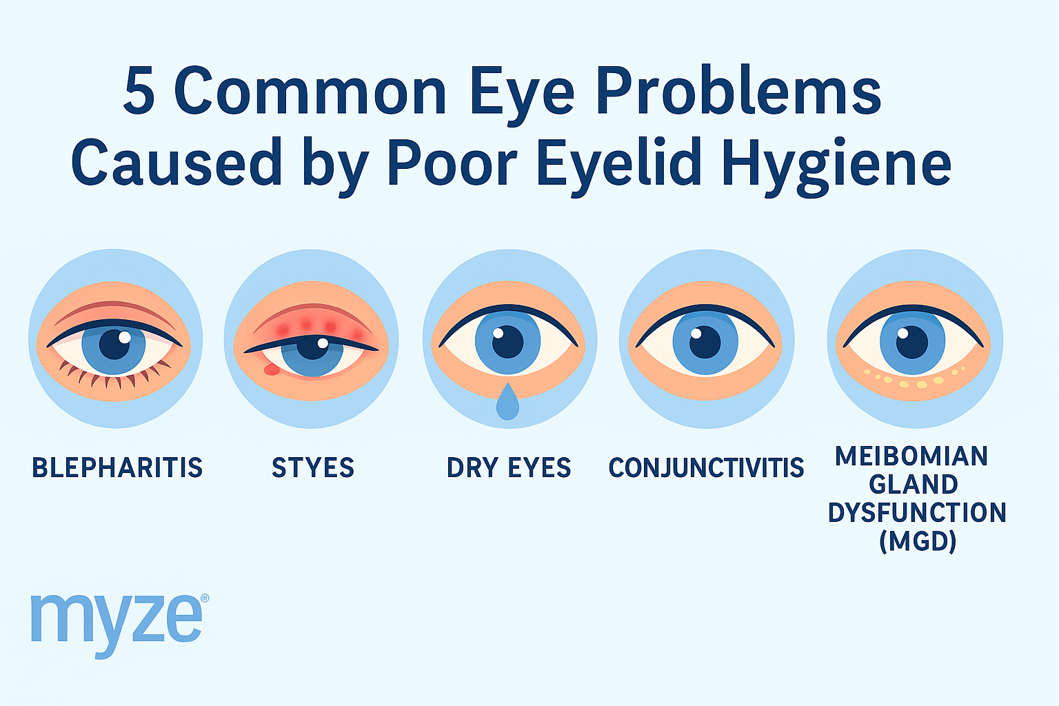 Infographic of 5 common issues caused by poor eyelid hygiene